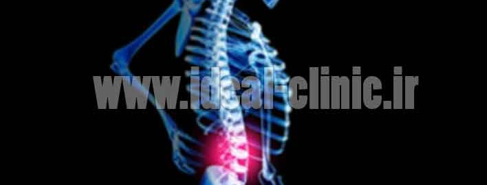 اصلی ترین علت ایجاد کننده دیسک کمر