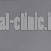 تزریق ژل هیالورونیک در لب