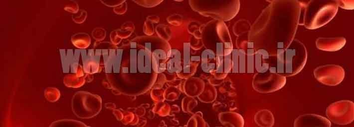 از کم خونی فقر اهن چه میدانید؟