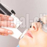 استفاده از لیزر برای حذف موهای زائد