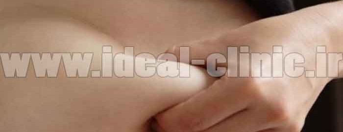با چربی شکم چه کنیم؟
