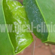 Aloe-Vera