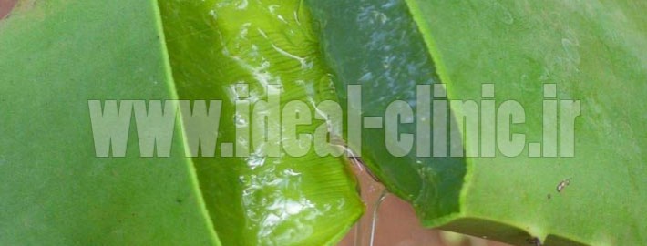 Aloe-Vera