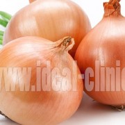 Onions