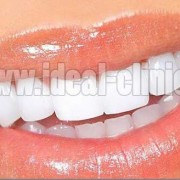 محافظت از دندان ها