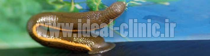 زالو درمانی مورد تایید سازمان غذا و داروی آمریکا (FDA)