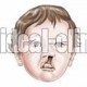 لب شکری یا شکاف لب و کام چیست؟